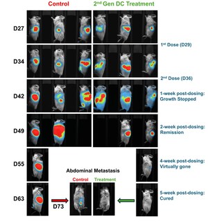 Lunai Bioworks achieves complete regression of both primary and metastatic pancreatic tumors in preclinical humanized models, marking a breakthrough in allogeneic cancer immunotherapy