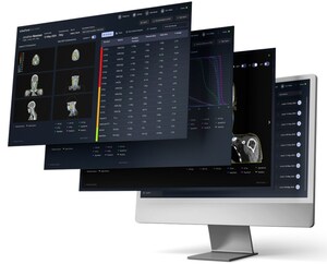 SeeTreat's ART.1 is now CE Marked under EU MDR - Bringing Adaptive Radiotherapy to Every Clinic