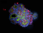 High-resolution image of a patient-derived colorectal cancer (CRC) organoid, acquired with the ImageXpress® HCS.ai Advanced High-Content Screening System using a 40X objective.