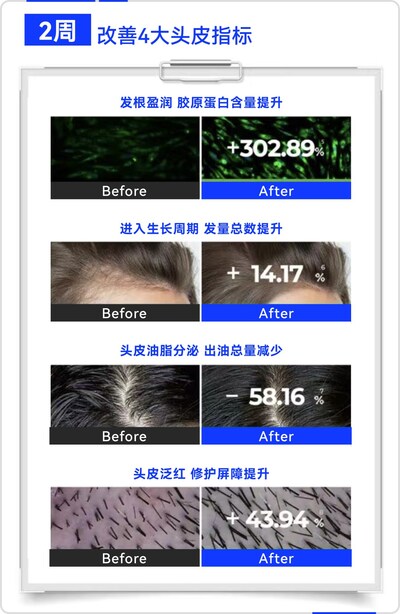 晶泰科技AI 研發平台開發的小分子Remeanagen™ 和多肽 AquaKine™聯用配方改善頭皮四大指標，有效固發防掉發