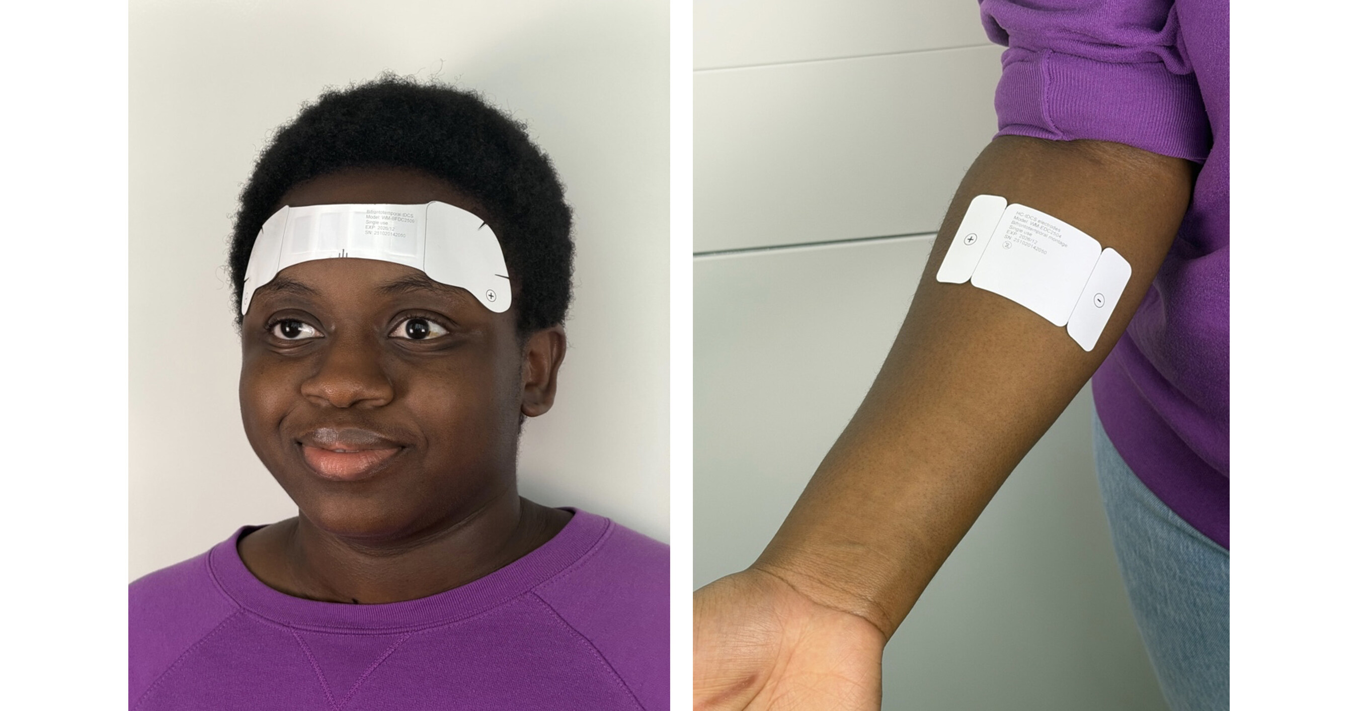 Grove School in medical breakthrough with wearable disposable electrotherapy Grove School in medical breakthrough with wearable disposable electrotherapy