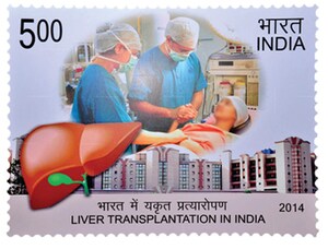 Apollo Hospitals Achieves Historic Milestone: Completes 5,000 Liver Transplants, Sets a New Benchmark for Indian and South Asian Healthcare