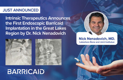Intrinsic Therapeutics Announces the First Endoscopic Barricaid Implantation in the Great Lakes Region by Dr. Nick Nenadovich Intrinsic Therapeutics Announces the First Endoscopic Barricaid Implantation in the Great Lakes Region by Dr. Nick Nenadovich