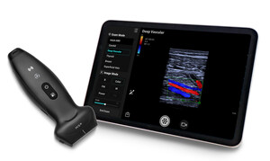 Mindray Introduces TE Air e5M Wireless Handheld Ultrasound to Revolutionize Whole-Body Scanning