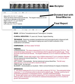 rScriptor SmartMacros Transform Radiology Reporting