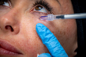 MicronJet™ Continues Its Journey to Become the Gold Standard in Intradermal Delivery