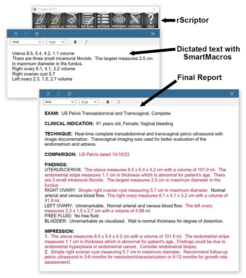 rScriptor SmartMacros
