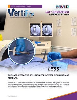 New System to Safely Remove Vertiflex Implants and Preserve the Spinous Processes -- Launched by KIC Ventures
