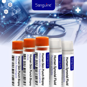 Sanguine Biosciences Expands Clinical Biospecimen Portfolio With New Synovial Fluid and Skin Punch Biopsy Offerings
