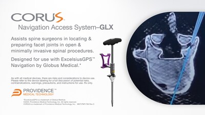 CORUS™ Navigation Access System–GLX assists spine surgeons in locating & preparing facet joints in open &
minimally invasive spinal procedures and is designed for use with ExcelsiusGPS™ Navigation by Globus Medical. CORUS™ Navigation Access System–GLX assists spine surgeons in locating & preparing facet joints in open &
minimally invasive spinal procedures and is designed for use with ExcelsiusGPS™ Navigation by Globus Medical.