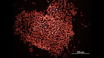 Induced pluripotent stem cells in the shape of a heart. Credit: Valentina Fossati, NYSCF.
