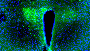 Day &amp; night: Cancer disrupts the brain's natural rhythm