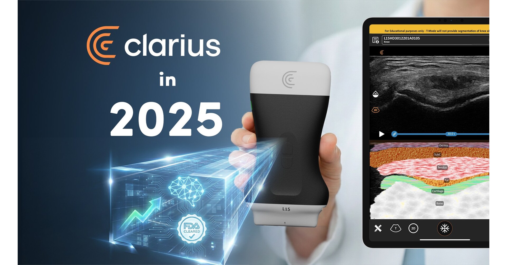 Clarius Mobile Health Announces Historic 2025: Achieves Profitability, Double-Digit Growth, and New FDA Clearances for Ultrasound AI