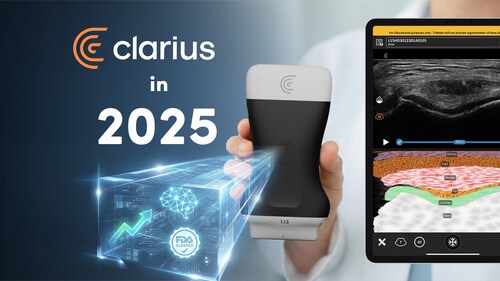 Clarius is announcing historic achievements in 2025, achieving profitability, double digit growth and new FDA clearances for ultrasound AI. (PRNewsfoto/Clarius Mobile Health)