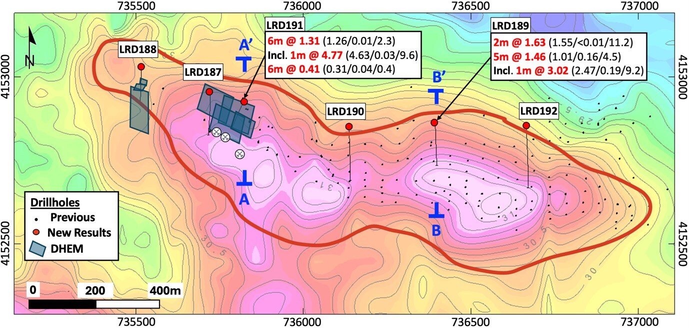 Figure 1 – La Romana gravity anomaly map showing locations of new drillholes LRD187 to LRD192, and cross-section locations A-A’ (Figure 2) and B-B’ (Figure 3) (CNW Group/Pan Global Resources Inc.) Figure 1 – La Romana gravity anomaly map showing locations of new drillholes LRD187 to LRD192, and cross-section locations A-A’ (Figure 2) and B-B’ (Figure 3) (CNW Group/Pan Global Resources Inc.)