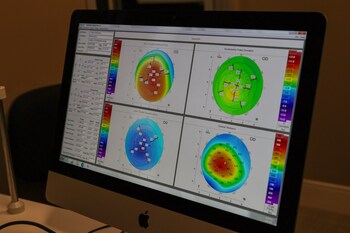 Advanced Dry Eye Testing