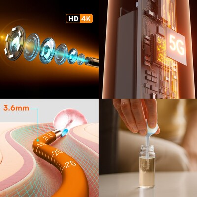 Features of Bebird EarSight Ultra X