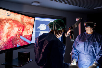 Surgeons use XRlabs intelligent visualization system powered by NVIDIA Jetson Thor and NVIDIA Isaac for Healthcare during a simulated neurosurgical procedure. Surgeons use XRlabs intelligent visualization system powered by NVIDIA Jetson Thor and NVIDIA Isaac for Healthcare during a simulated neurosurgical procedure.
