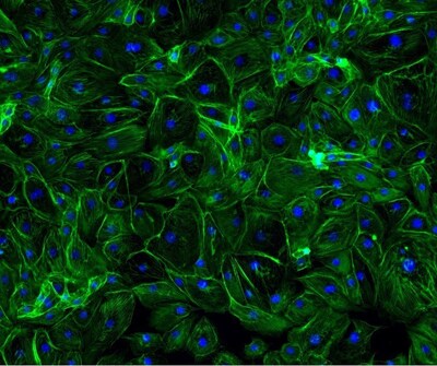 Photo: Debut. Microscopic image of cultured cells Photo: Debut. Microscopic image of cultured cells