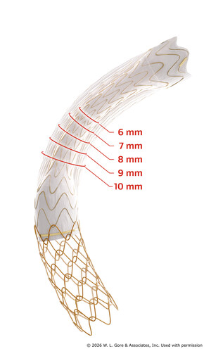 MARCA CE PARA LA NUEVA GAMA DE DIÁMETROS DE LA ENDOPRÓTESIS GORE® VIATORR® TIPS CON EXPANSIÓN CONTROLADA