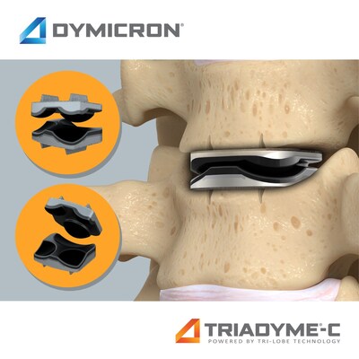 Dymicron's Triadyme-C Cervical Artificial Disc