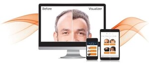 Atlanta Hair Transplant Specialist Dr. Benjamin Stong of Kalos Hair Transplant Named 2026 Top Patient Rated Doctor by Find Local Doctors