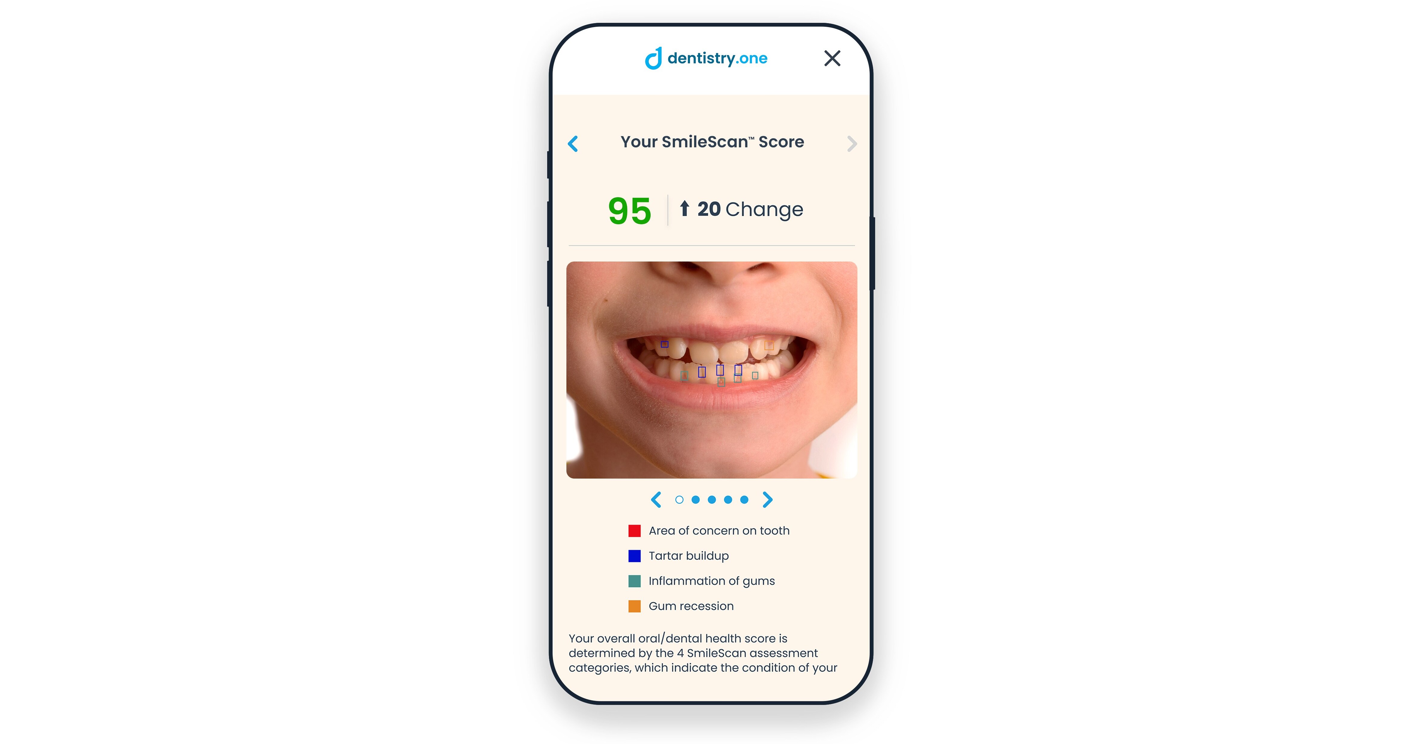 US Children to Gain New Access to Dental Care with Dentistry.One and America’s ToothFairy Partnership