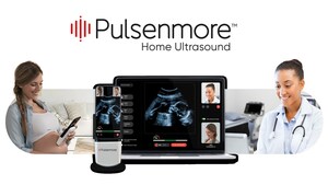 Pulsenmore To Commence Trading on Nasdaq as It Expands FDA-authorized Home Prenatal Ultrasound Devices in the U.S.