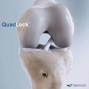 ABANZA Secures FDA 510(k) Clearance for QuadLock™ Fixation System for ACL Reconstruction