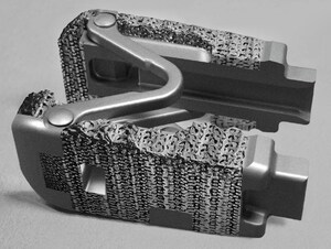 Spine Innovation Announces FDA 510(k) Clearance for LOGIC™ Titanium Expandable Interbody System