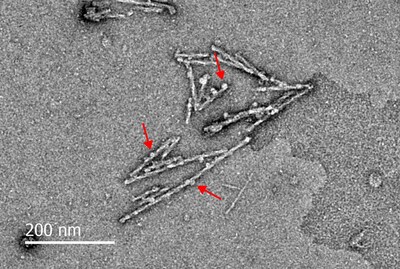 Image (Funes_Orb2_electronmicro): 
Electron microscopy image of Orb2 amyloid fibers. Red arrows indicate Funes, the chaperone protein, aiding in the assembly of Orb2 amyloid.