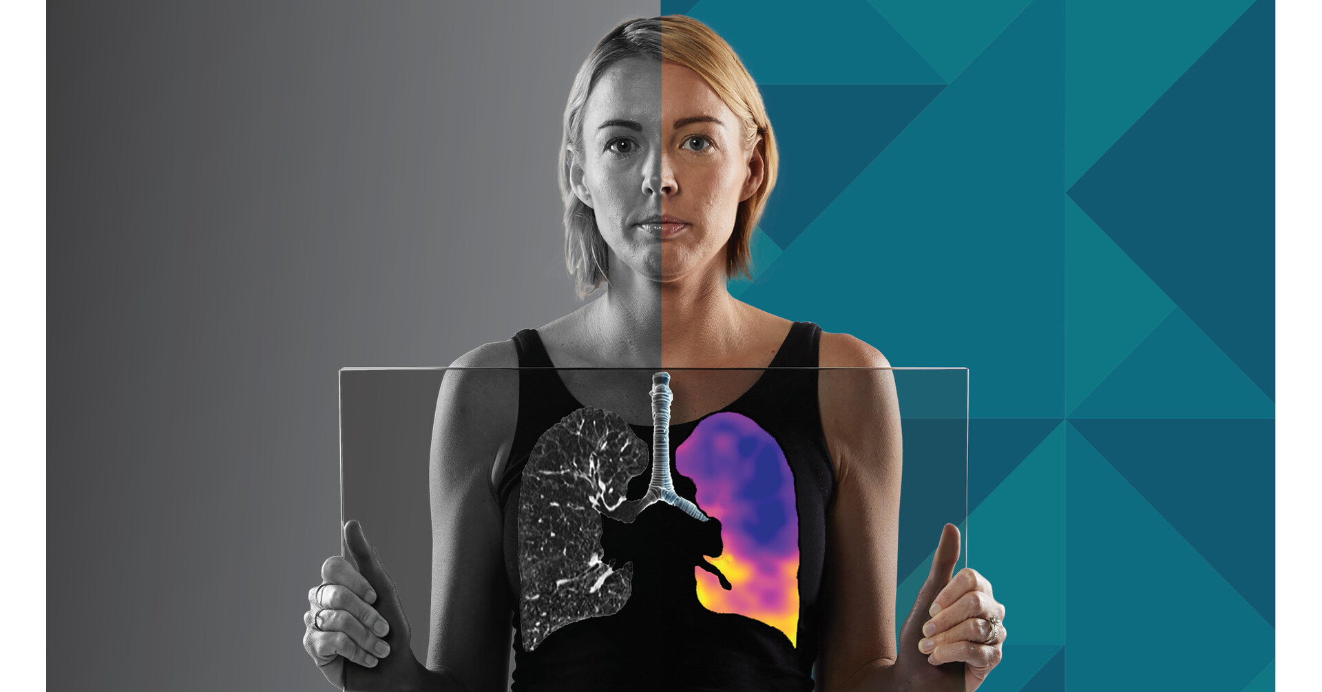 4DMedical Secures US$100+ Million Funding to Accelerate U.S. Expansion and increase Technology Dominance in Software-Based Lung Imaging