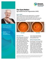 Prevent Blindness offers free fact sheets in English and Spanish for its Age-related Macular Degeneration and Low Vision Month in February.