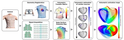 Workflow of volumetric ECGI technology developed by Corify