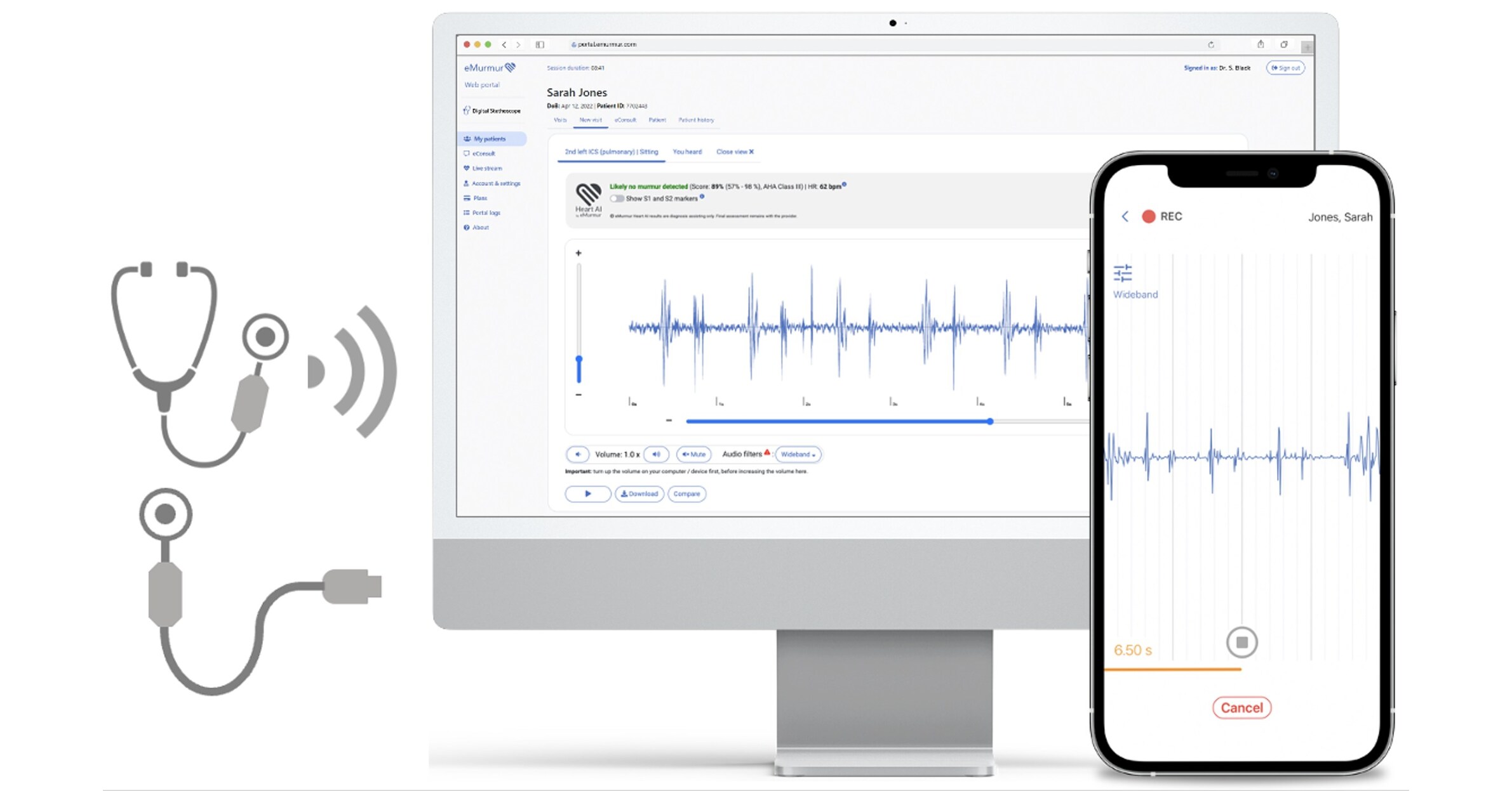 eMurmurs Open Medical AI Receives FDA Clearance, Enabling Murmur Detection Across Digital Stethoscope Models and Third-Party Software