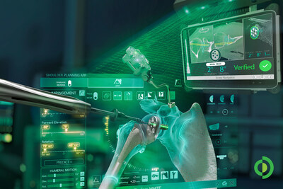 Advita Ortho expands its navigation platform with the next-generation GPS Shoulder system, featuring an updated station and software designed for a faster, more intuitive surgical experience.