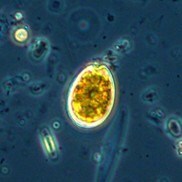 Incheon National University Researchers Uncover Hidden Toxin Risks During Nutrient-Starved Algal Blooms