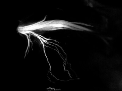 A new roadmap to surgery - IND-approved LGW16-03, also known as NerveTrace Dx, enables real-time visualization of complex nerve anatomy so surgeons can cut by color to spare critical nerves and improve patient outcomes.