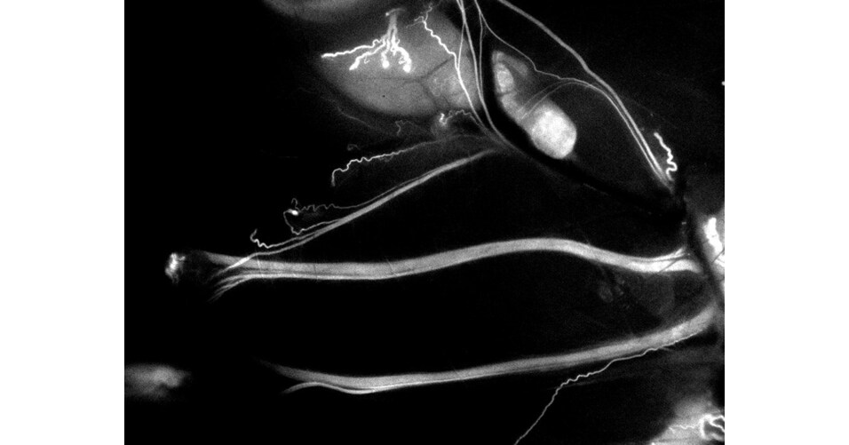 Trace Biosciences Announces FDA IND Clearance for First Nerve-Specific Imaging Agent Trace Biosciences Announces FDA IND Clearance for First Nerve-Specific Imaging Agent