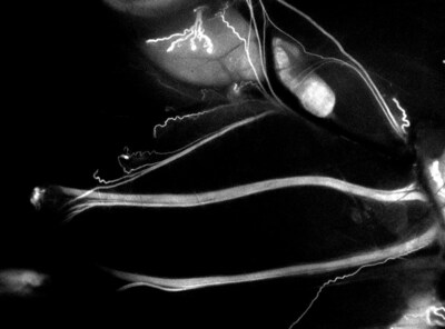 See the unseen - high contrast nerve imaging using nerve-specific fluorescence. Trace Biosciences' proprietary imaging agents provide clear visualization of complex nerve anatomy, including sub-millimeter nerve branches otherwise invisible to the naked eye.
