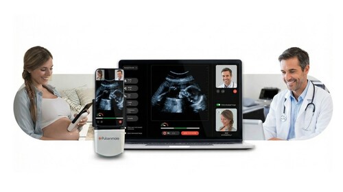 Pulsenmore - home ultrasound (PRNewsfoto/Pulsenmore Ltd.) Pulsenmore - home ultrasound (PRNewsfoto/Pulsenmore Ltd.)