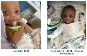 Federal Jury Awards $9 Million Verdict Against Los Angeles County DCFS for Death of 7-Month-Old Infant