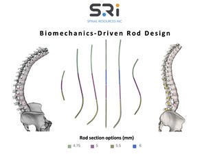 First-of-its-kind Universal Clearance Establishes Maximum Regulatory Access to the Bezier Parametric Curve Spinal Rod System for Patients and Surgeons