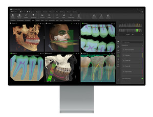 DEXIS SETS A NEW BENCHMARK FOR DIGITAL DENTISTRY WITH ADVANCED AI AND SEAMLESS CONNECTIVITY