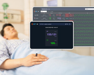 Sky Labs lanza 'CART ON', la primera solución portátil de monitorización de la presión arterial tipo anillo