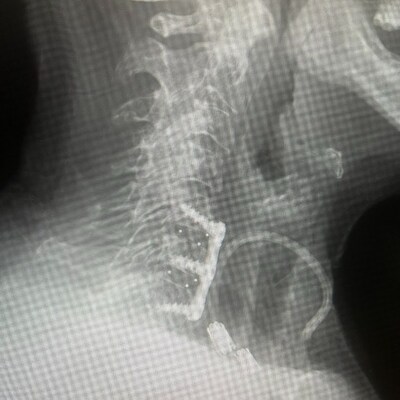 Unable to view the image, Please provide a valid URL.