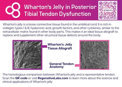 Posterior tibial tendon dysfunction (PTTD) is a progressive degenerative tendinopathy often unresponsive to conservative care, necessitating surgical interventions with significant postoperative risks.