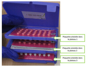 Avis public - Les pilules contraceptives Seasonique et Seasonale font l'objet d'un rappel en raison de la possibilité d'une plaquette alvéolée manquante