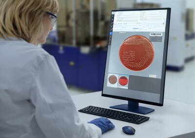 L'autorisation 510(k) de la FDA établit une large indication d'utilisation pour le logiciel PhenoMATRIX® de Copan, élargissant les capacités de microbiologie clinique