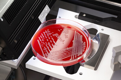 O sistema Copan capta imagens de alta resolução de placas de cultura para avaliação digital.